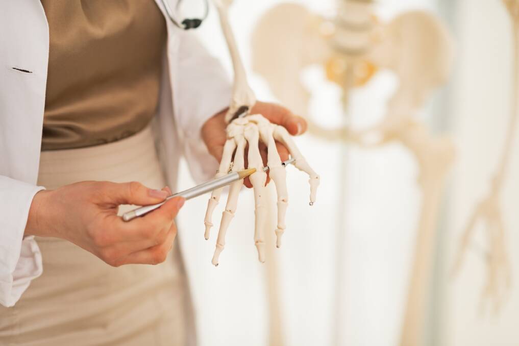 COSTLY FRACTURES: Poor bone health is expected to cost $3.1 billion nationally this year. Picture: iStock