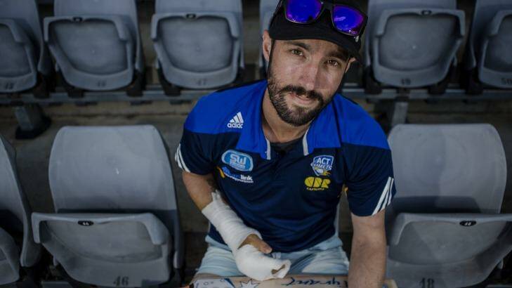 ACT Comets batsman Jono Dean with his dislocated finger in a cast at Manuka Oval on Wednesday.
 Photo: Jamila Toderas