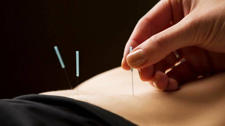 Acupuncture is no better than a sham treatment for treating hot flushes.  