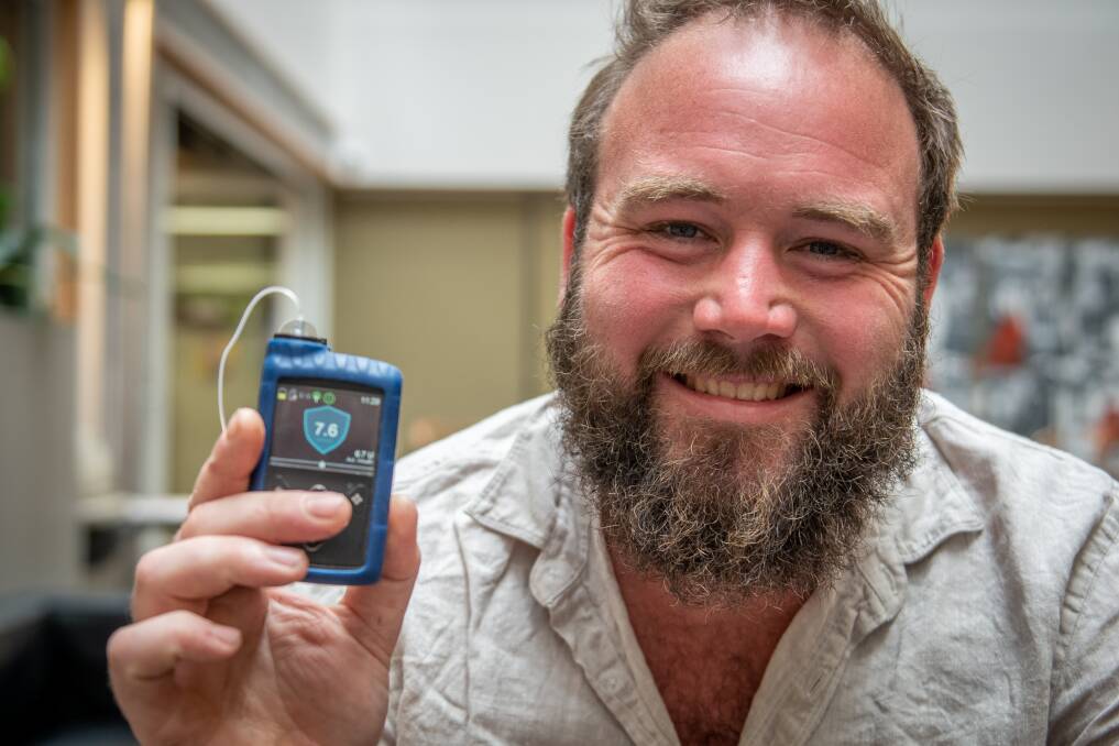 GET PUMPED: Daniel Webb shows off his insulin pump. Picture: Paul Scambler 