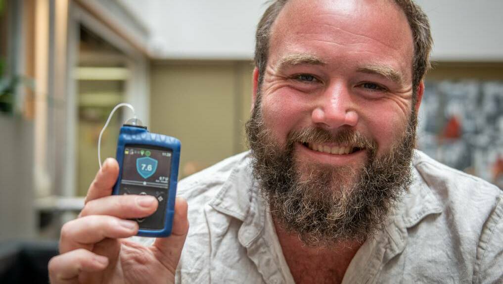 Daniel Webb with pump for glucose monitoring.