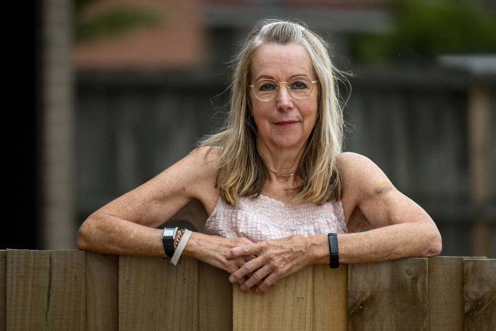 Ravenswood woman Gillian Coombe says a government program to ease access to antibiotics to treat urinary tract infections has excluded men and women over 65. Picture by Phillip Biggs