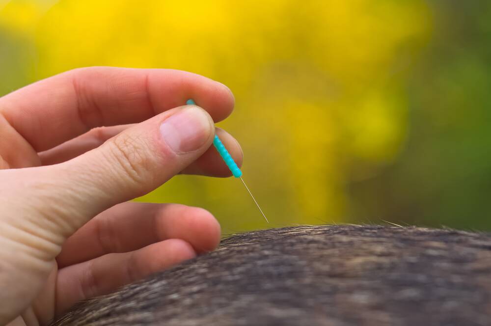 CONSIDER ALTERNATIVES: Acupuncture can augment conventional treatment.