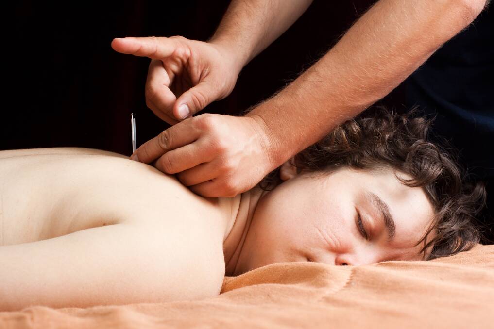 MODERN TWIST: Where acupuncture uses body maps developed over thousands of years, dry needling is guided by the individual anatomy and problems of the patient.
