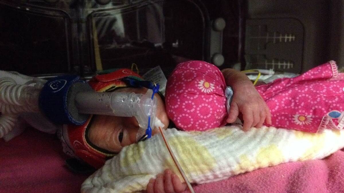 TINY: Jazmin after her birth at the Royal Hobart Hospital. 