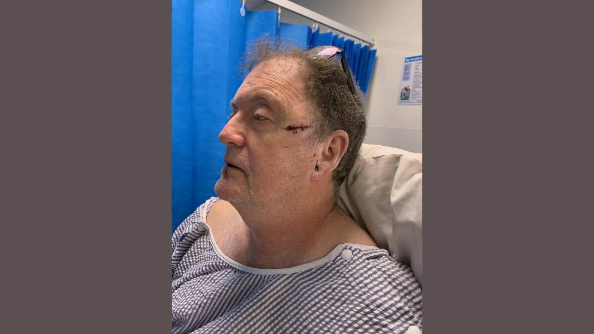 Green Bean owner Paul Giddins after the assault. Picture: Supplied 