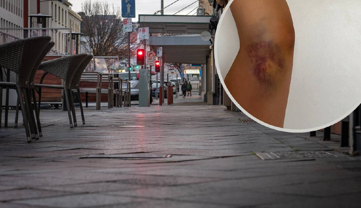Ebony Page, 21, suffered bruising to her head and arms, cuts and abrasions, and a concussion as a result of a late-night attack on George Street. Picture: Paul Scambler/supplied