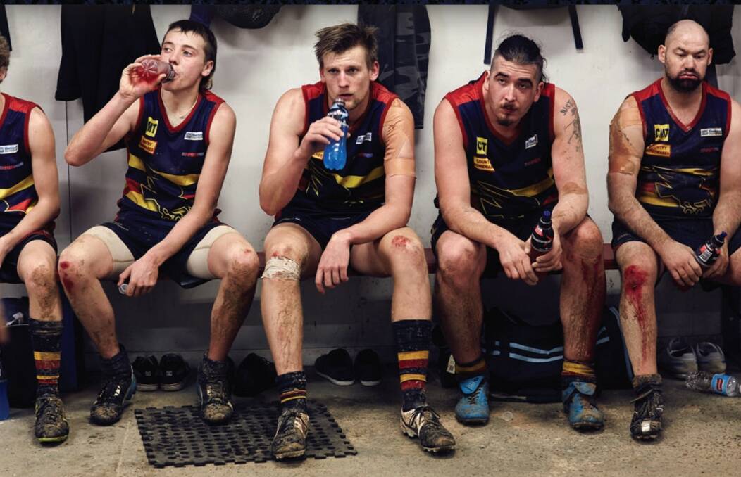 Queenstown Crows players with scarred and battered knees from playing at their oval, featured on the cover of Gravel and Mud. Picture: Sean Fennessy 
