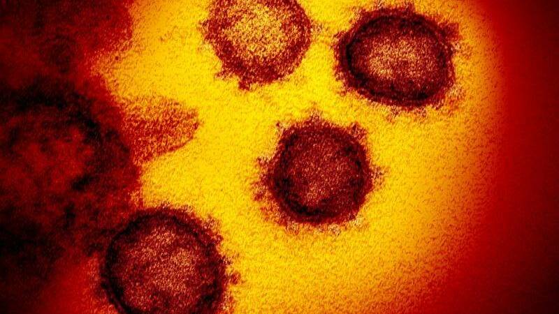 Five new coronavirus cases confirmed