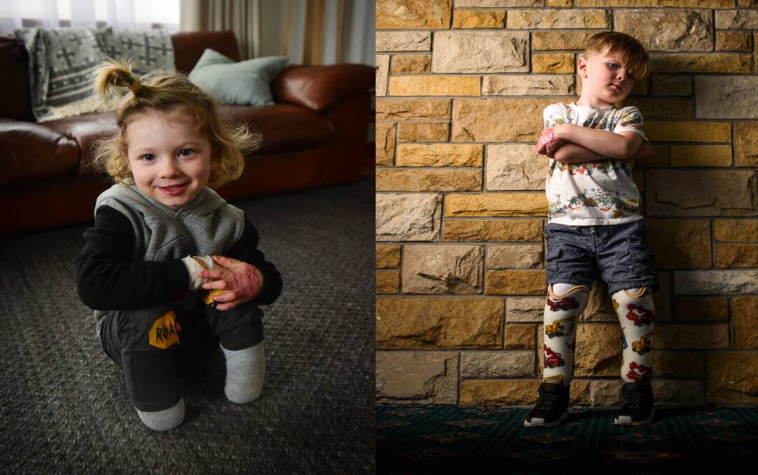 Before and after: Paul Scambler's photograph of Arthur Long before his prosthetic legs were fitted and Scott Gelston's follow up a few months later capture the little boy's lust for life.
