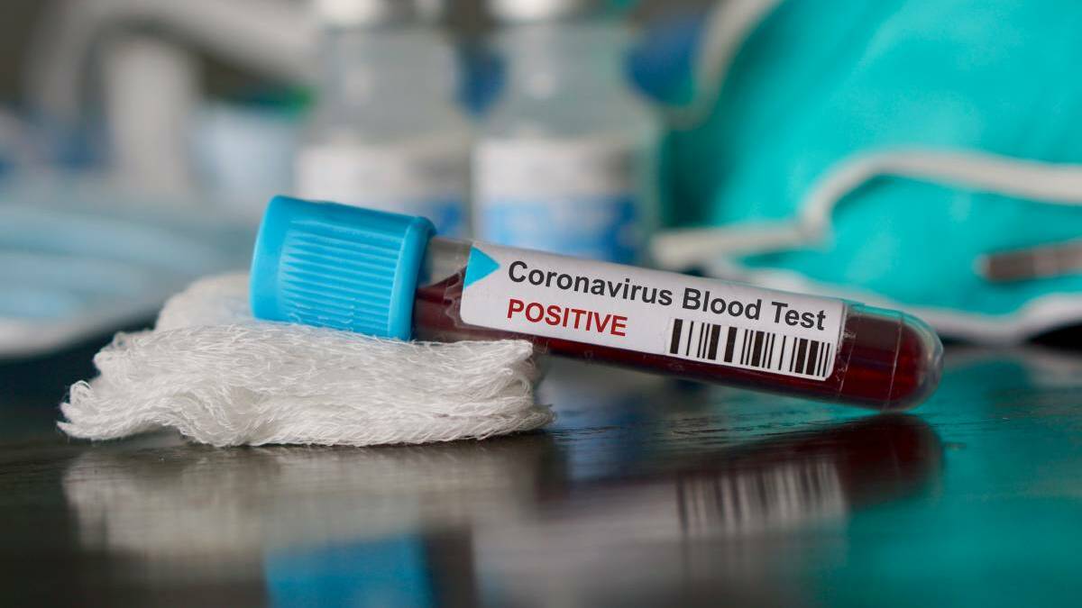 Technical bungle causes coronavirus test referral issues