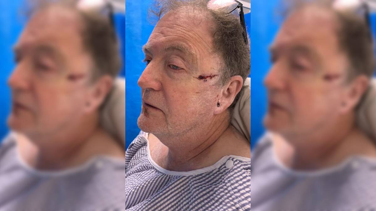 Green Bean Cafe owner Paul Giddins after he was assaulted in broad daylight. 