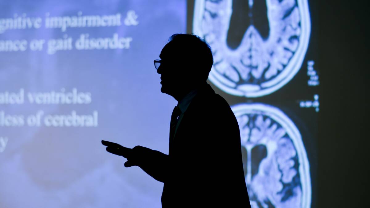 Doctor's dementia study a brain changer