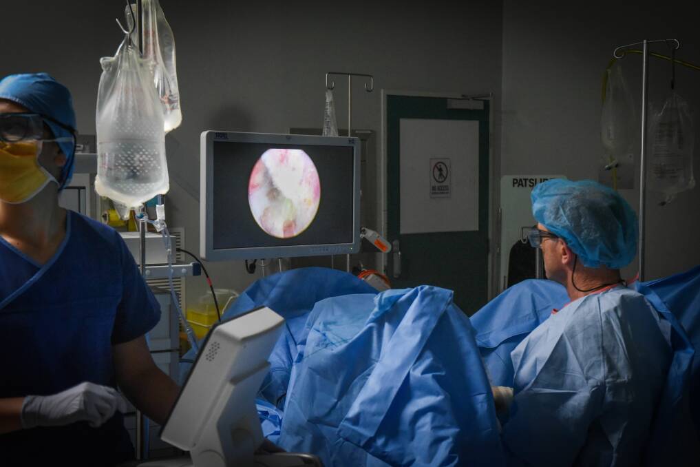 HEALTH: Urologist Stephen Brough performs the first surgery using the Lumenis Pulse 100H Holmium Laser platform at Calvary St Vincent's Hospital. Picture: Paul Scambler 