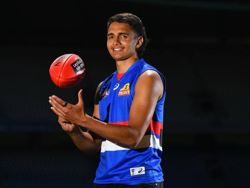 The Bulldogs' No.1 AFL draft pick Jamarra Ugle-Hagan has dislocated his thumb in a practice match.