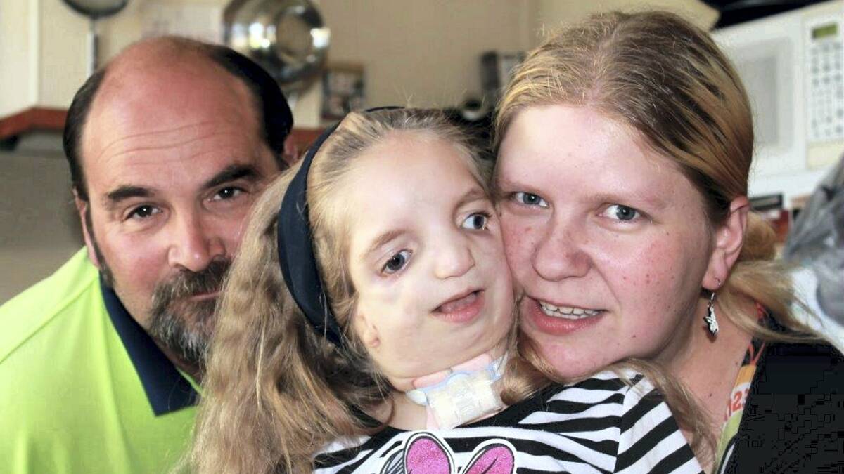 Mark Tregoning and his wife Sue are amazed by the support their daughter Natalie, 4, who has Treacher Collins syndrome, is receiving from the community.