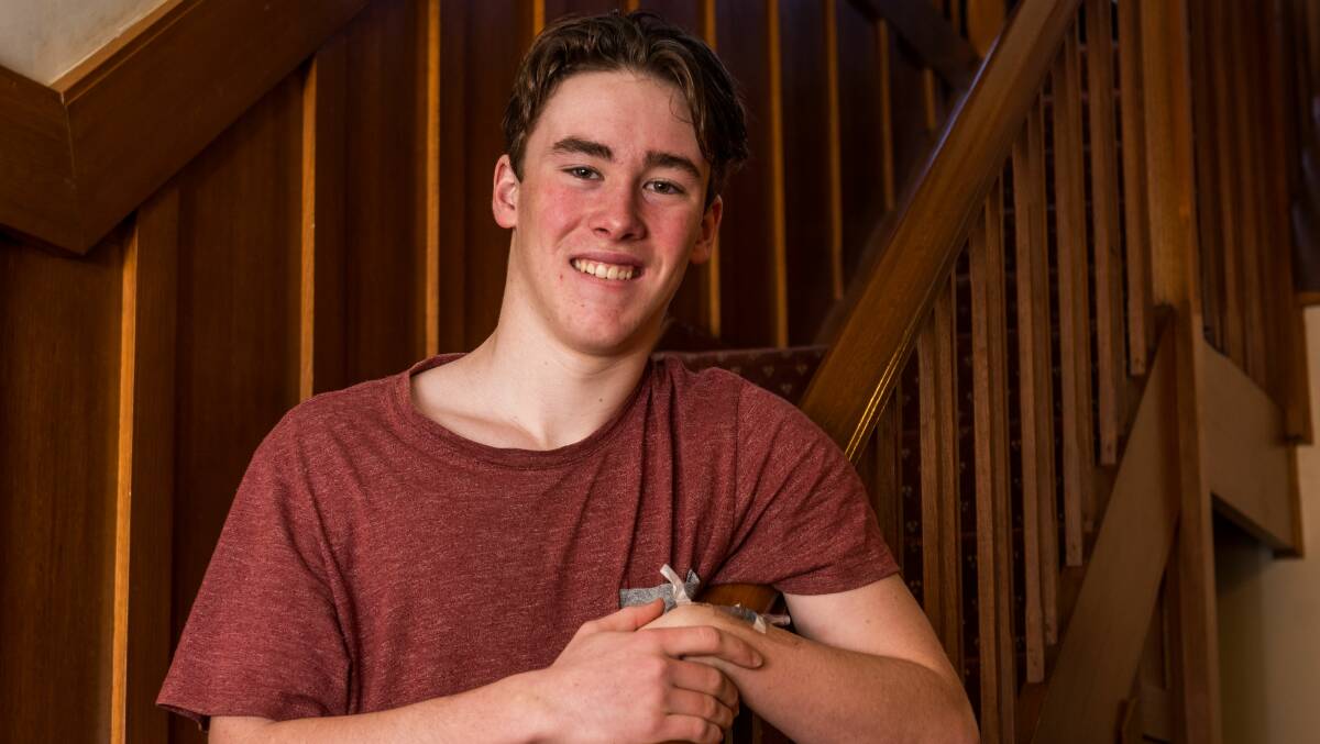 CLOSE CALL: Alex Beaumont, 15, is recovering at his Launceston home after being diagnosed with meningococcal disease. Picture: Phillip Biggs